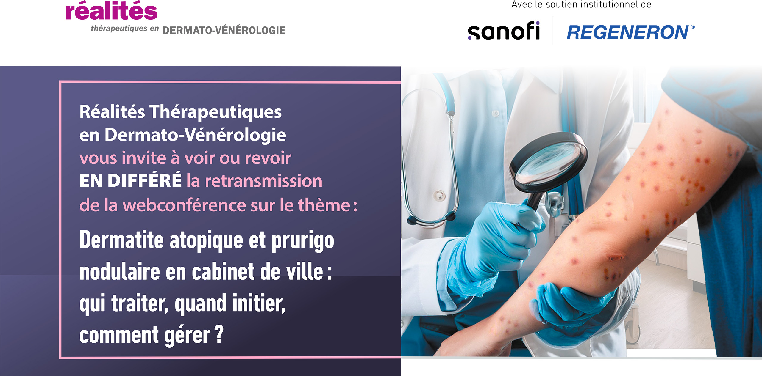 Dermatite atopique et prurigo nodulaire en cabinet de ville : qui traiter, quand initier, comment gérer ?